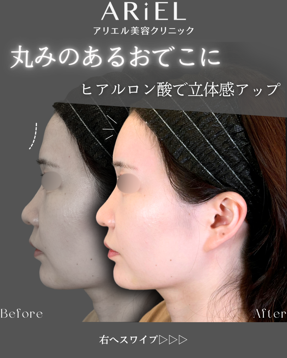 No.9101の症例写真
